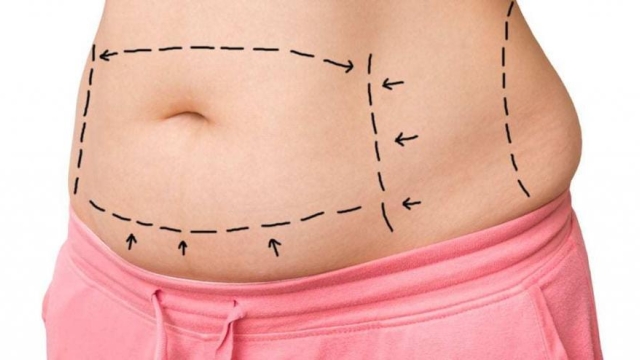 Slimming Secrets: Unveiling the Power of Liposuction