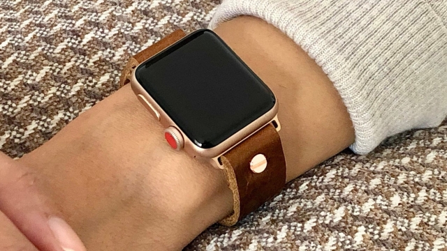 Unleash Your Style with These Stylish Apple Watch Bands!