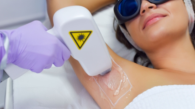 Smooth and Silky: Unveiling the Wonders of Laser Hair Removal